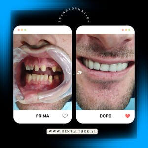 Image of Dental Turk Albania Gallery 1