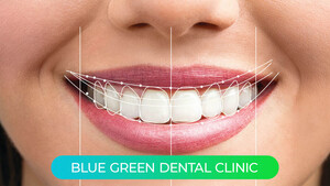 Image of Blue Green Dental Clinic Gallery 1