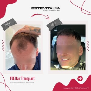 Image of Estevitalya Hair Gallery 0