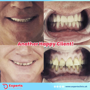 Image of Experts Dental Clinic Gallery 2