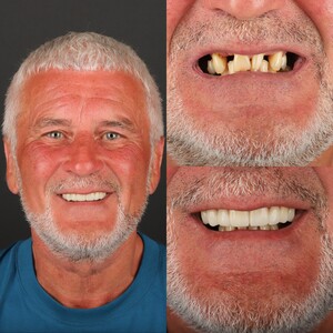 Image of Smile Makeover