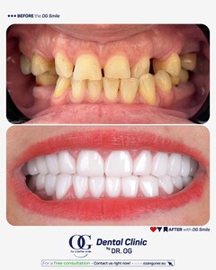 Image of Smile makeover