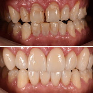 Image of Cosmetic dentistry