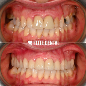 Image of Dentista Albania - Elite Dental Gallery 2