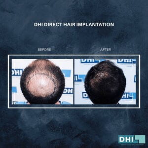 Image of DHI Malaysia Gallery 2