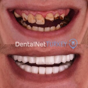 Image of Dental Net Turkey Gallery 0