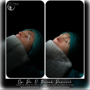 Image of Op Dr Burak Demirel ENT and Facial Aesthetics Clinic Gallery 1