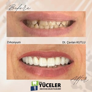 Image of Yüceler Oral and Dental Health Clinic Gallery 0