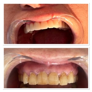 Image of Go Dental Clinic  - Dt. Fahriye Gül Cura Gallery 0