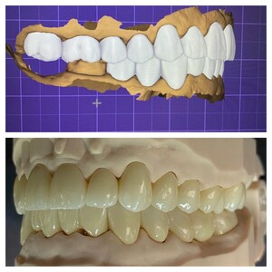 Image of CAD-CAM - LLL Dental