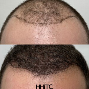 Image of Houston Hair Transplant Center - Dr. Goran Jezic Gallery 2