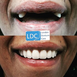 Image of London Denture Care Gallery 2