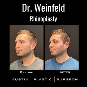 Image of Austin Plastic Surgeon Gallery 0