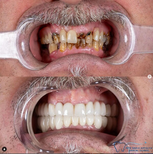 Image of New Smile Antalya Dental Clinic Gallery 3