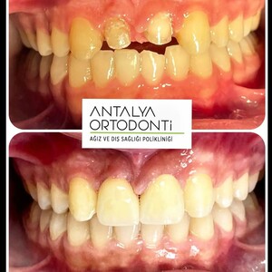 Image of Antalya Ortodonti Oral and Dental Health Polyclinic Gallery 1