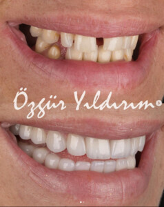 Image of Özgür Yıldırım Aesthetic Dental Clinic Gallery 2