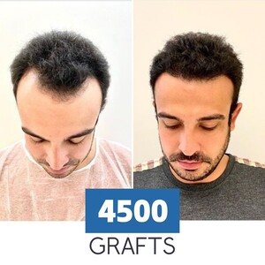 Image of Likya Aesthetic & Hair Transplant Gallery 2