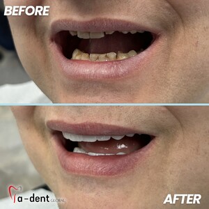 Image of A-dent Dental clinic Gallery 1