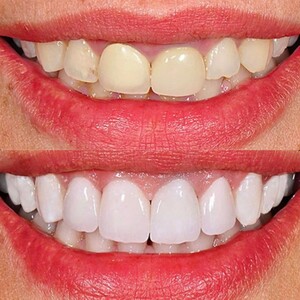 Image of Atk Dentpark Clinic Antalya Gallery 1