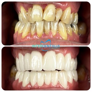 Image of InterAntalia Dental Clinic Gallery 1