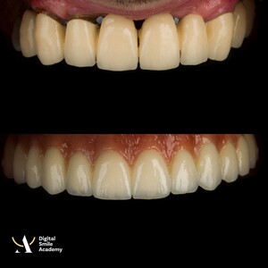 Image of Dental treatment