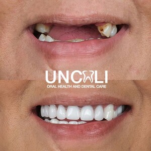 Image of Uncalı Dental Clinic Gallery 0