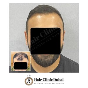 Image of The Hair Clinic Dubai Gallery 3