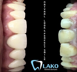 Image of Lako Dental Clinic Gallery 0