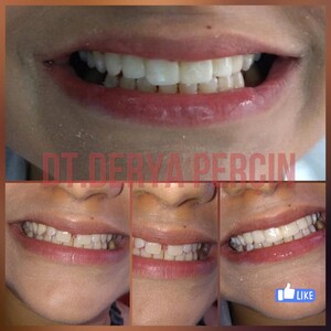 Image of DP Smile Dental Clinic Deutsche Zahnklinik Gallery 0