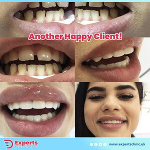 Image of Experts Dental Clinic Gallery 1