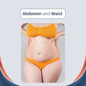 Image of Abdomen Surgery - Cauris Health