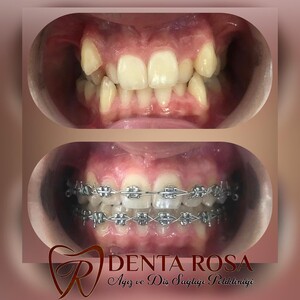 Image of Denta Rosa Oral and Dental Health Polyclinic Gallery 1