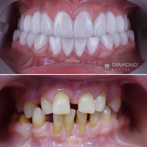 Image of Diamond Dental Gallery 2