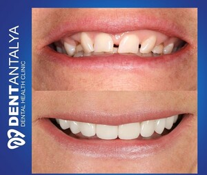 Image of DentAntalya Dental Health Clinic Gallery 2