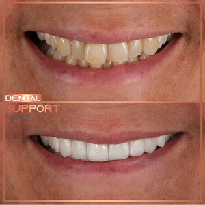 Image of Dental Support Turkey Gallery 1