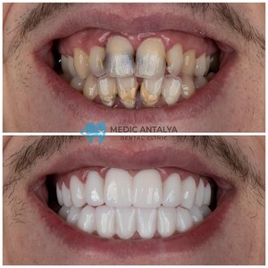 Image of Medic Antalya Dental Clinic Gallery 3