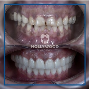 Image of Hollywood Dental Izmir Gallery 0