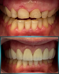 Image of Dental treatment - Dr Popovic