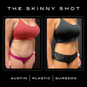 Image of Austin Plastic Surgeon Gallery 1