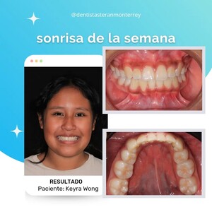 Image of Dental treatment