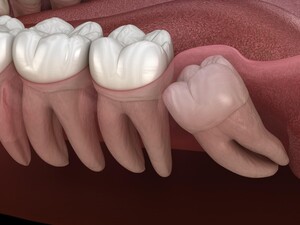 Image of Dental Ank Oral and Dental Health Center Gallery 1