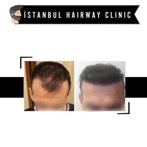 Image of İstanbul Hairway Clinic Gallery 2