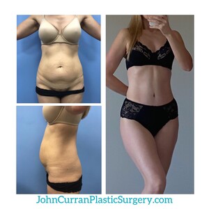 Image of MD.John Curran Plastic Surgery Gallery 3