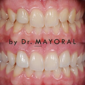 Image of Barcelona Smile Center by Dr. Mayoral Gallery 0