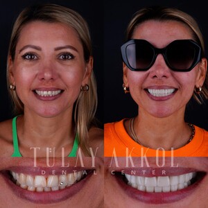 Image of Tülay Akkol Dental Center Gallery 0