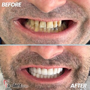 Image of A-dent Dental clinic Gallery 3