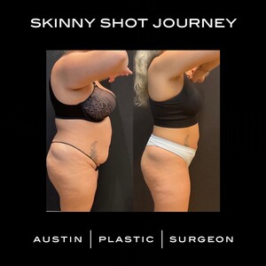 Image of Austin Plastic Surgeon Gallery 2