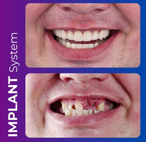 Image of Istadental - Istanbul Dental Aesthetic Clinic Gallery 2