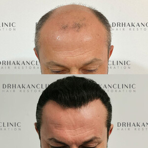 Image of Dr Hakan Clinic Gallery 2