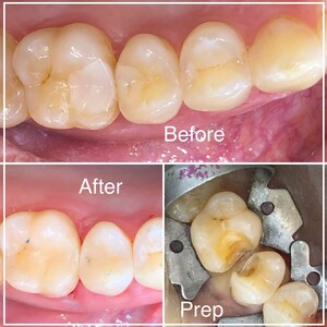 Image of Dental treatment - Amadenta